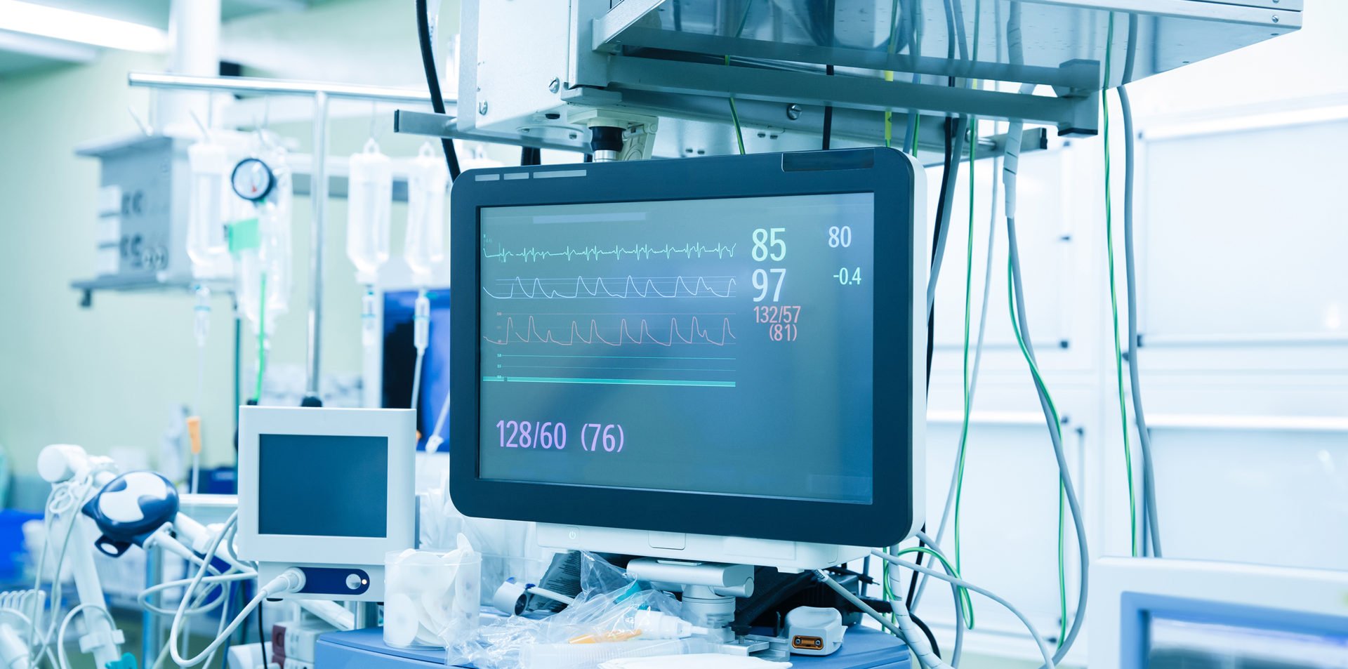 Functional vital functions (vital signs) monitor in an operating room with machines in the background, during real surgery on a patient. Life sustainment, monitoring and anesthesia concept.