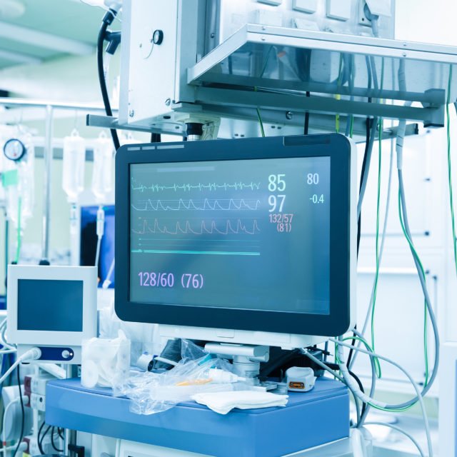Functional vital functions (vital signs) monitor in an operating room with machines in the background, during real surgery on a patient. Life sustainment, monitoring and anesthesia concept.